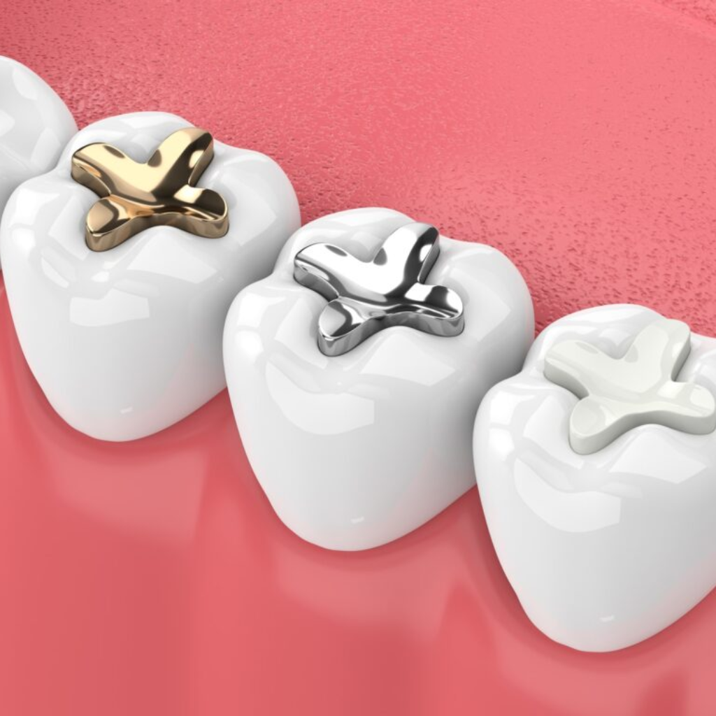 How Long Does a Fill Take: Complete Guide to Dental Filling Duration
